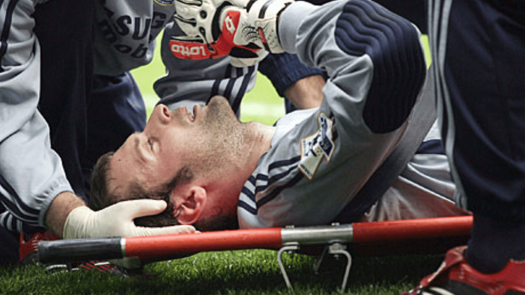 petr čech s skull fracture