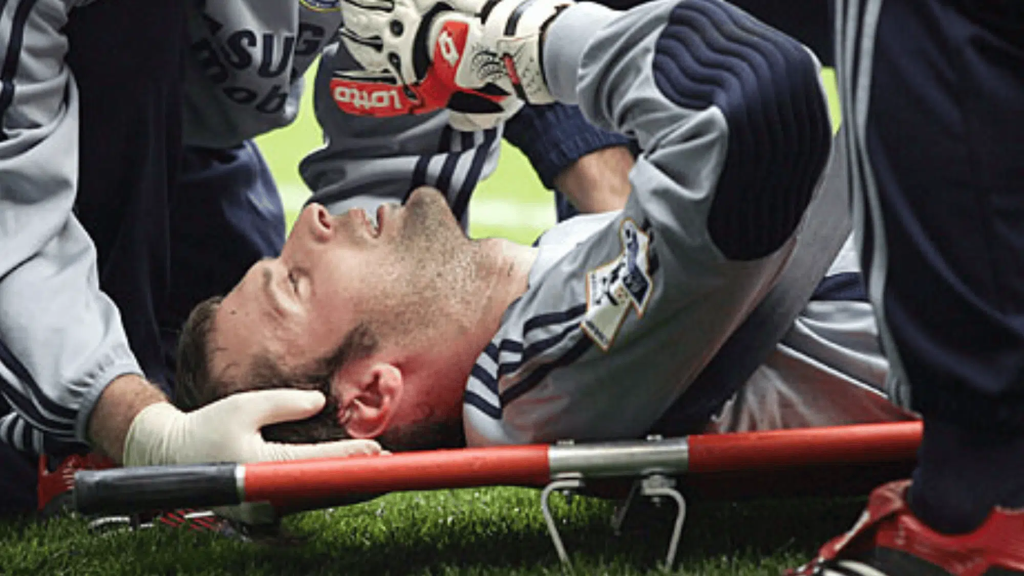 petr čech s skull fracture