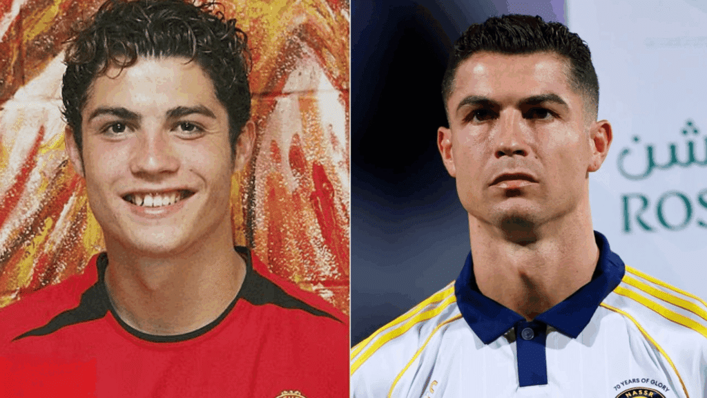 ronaldo before plastic surgery 2003 2025 timeline