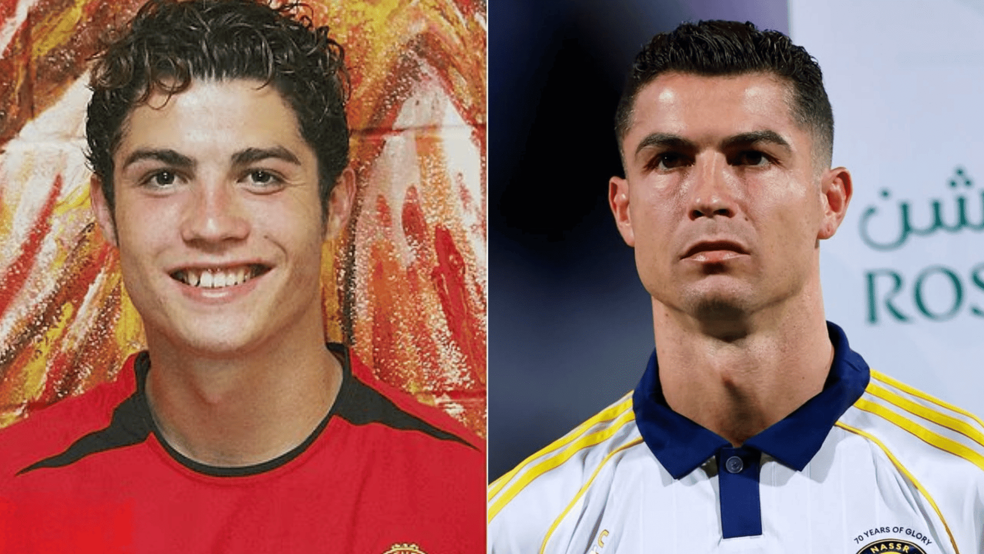 ronaldo before plastic surgery 2003 2025 timeline