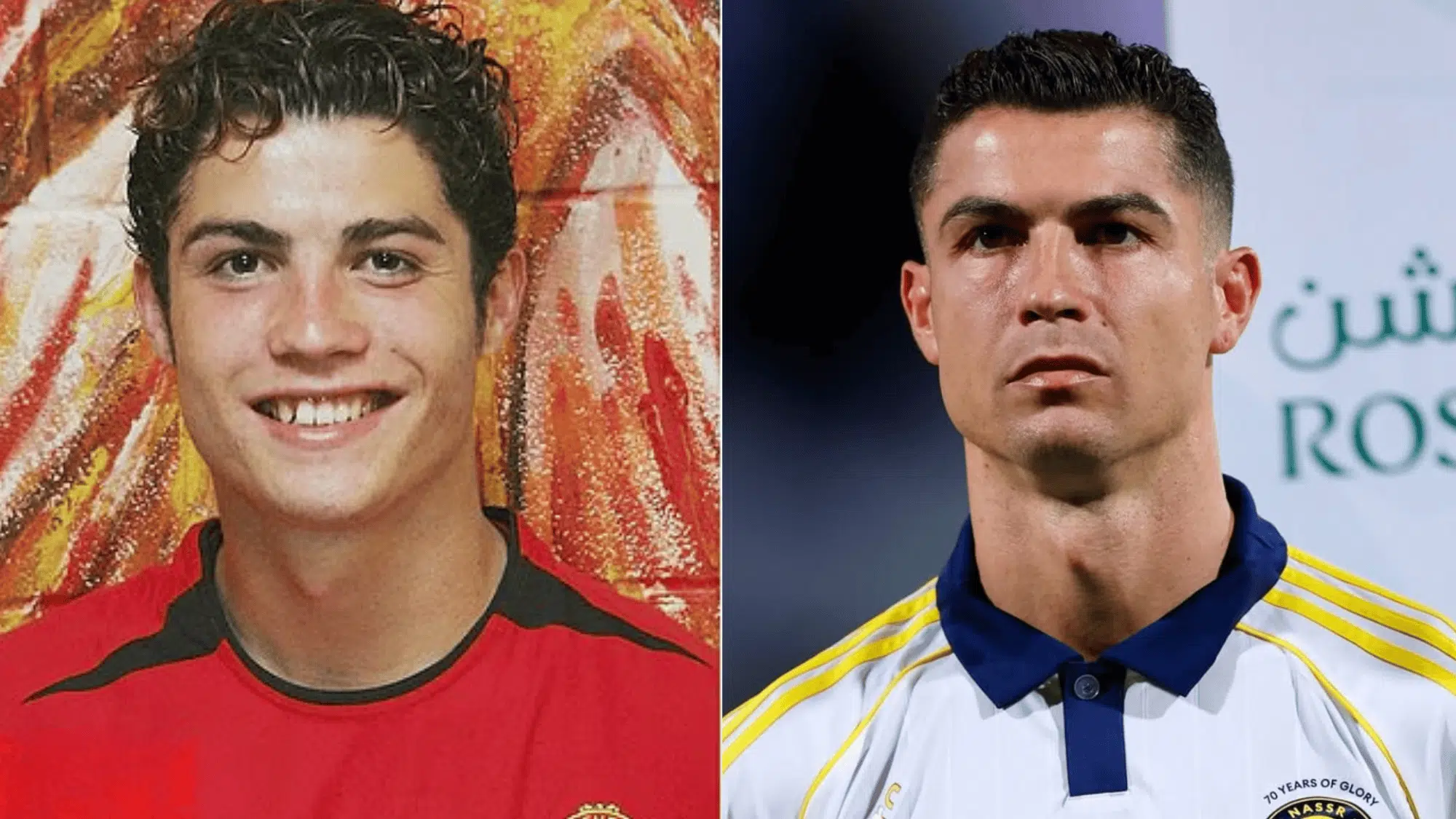 ronaldo before plastic surgery 2003 2025 timeline
