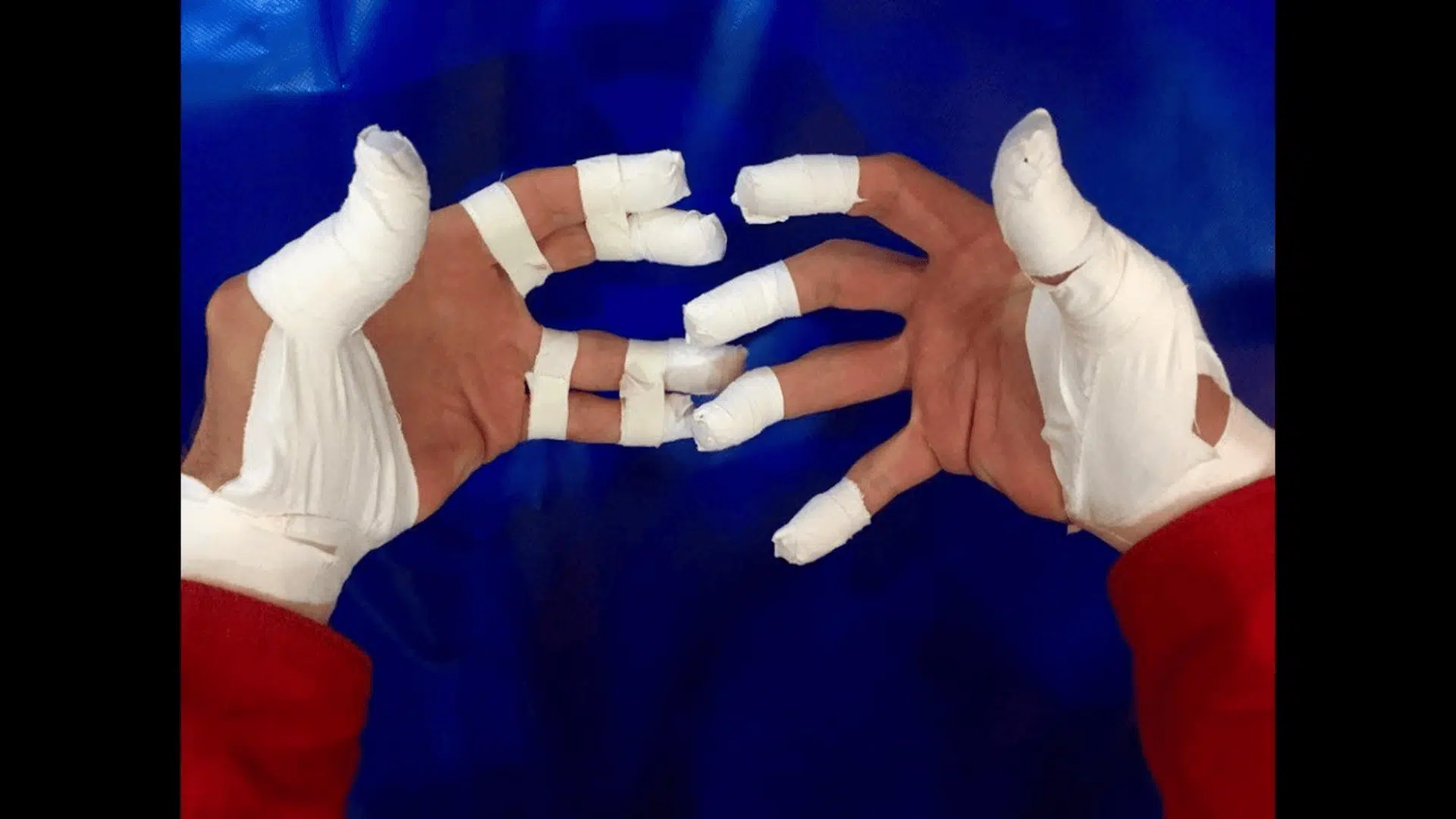 both hands wrapped in white athletic tape, likely for injury prevention or recovery, commonly seen in sports