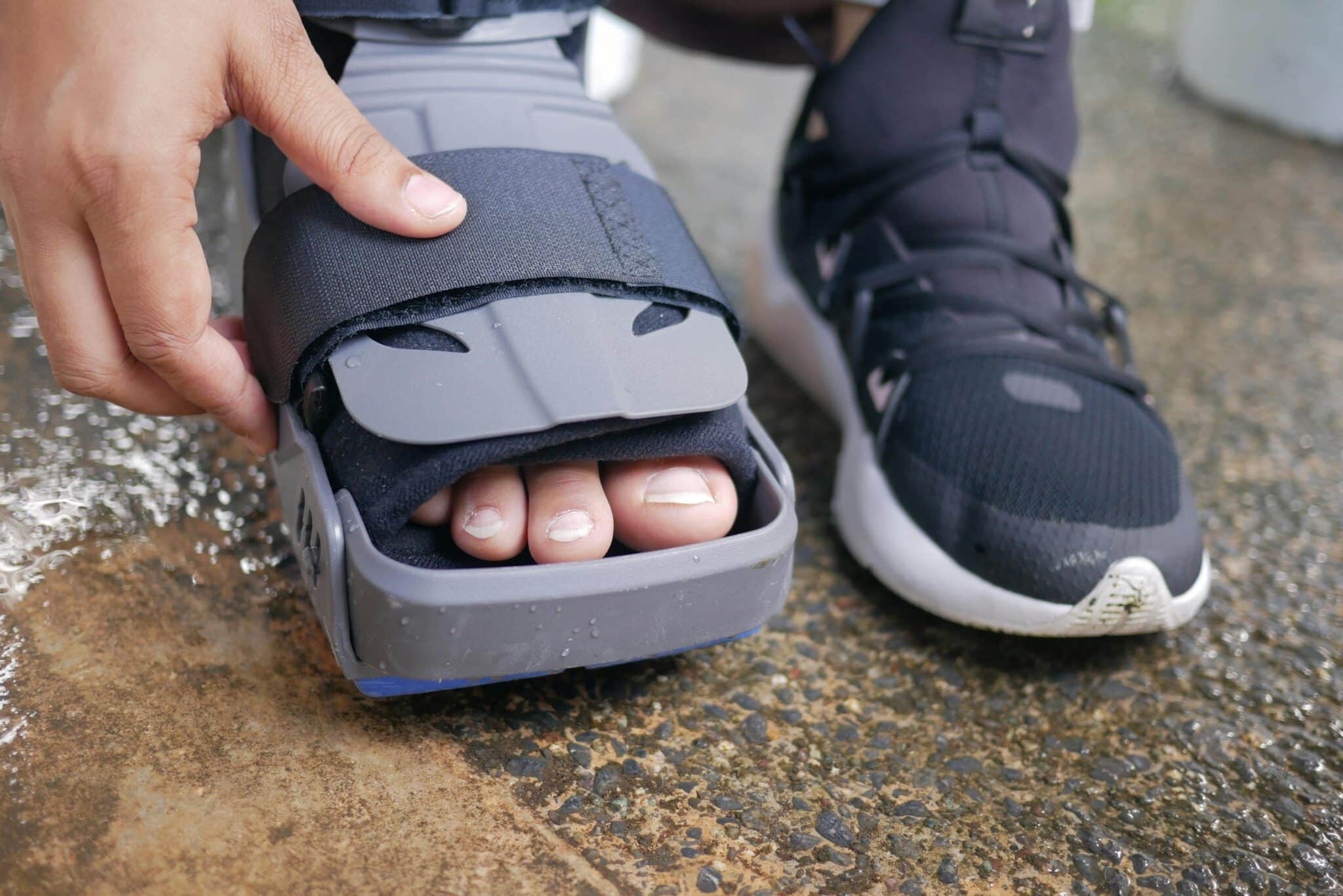 Walking Boots and Braces