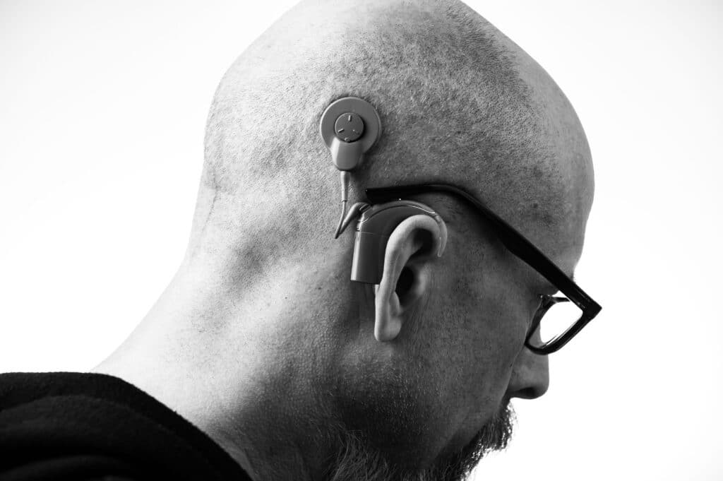 Vagus Nerve Stimulators